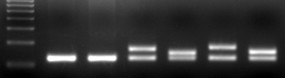 DNA elektroforeza DNA elektroforeza