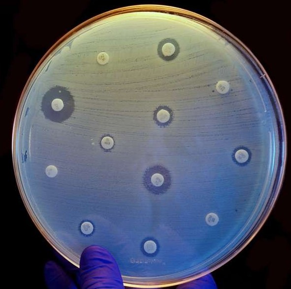 Proučavanje povezanosti zagađenja okoliša antibioticima i razvoja rezistencije na antibiotike u ljudskih patogena