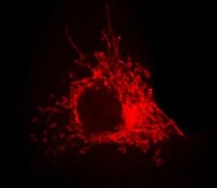 ER alpha_nucleus ER alpha_nucleus