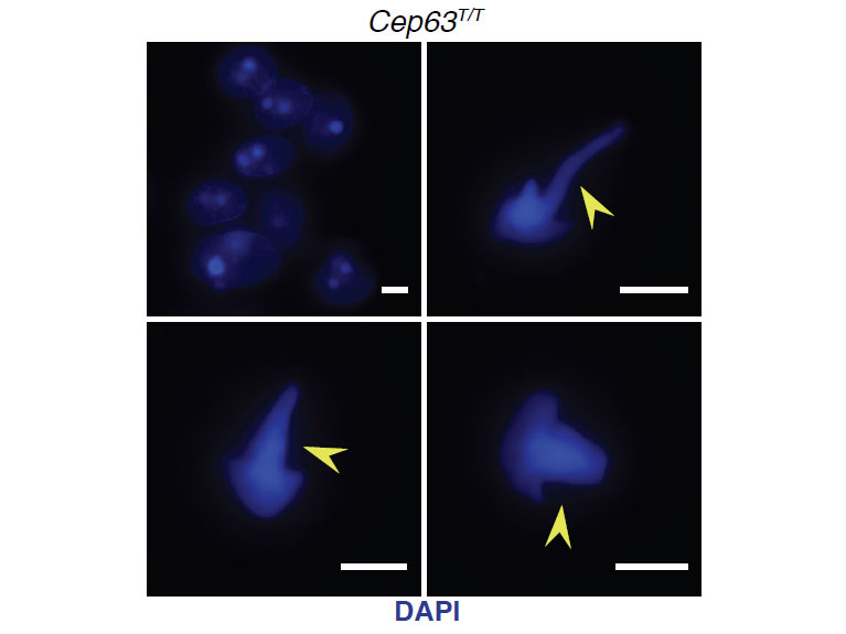 A Key Role for CEP63 in Brain Development and Fertility Discovered