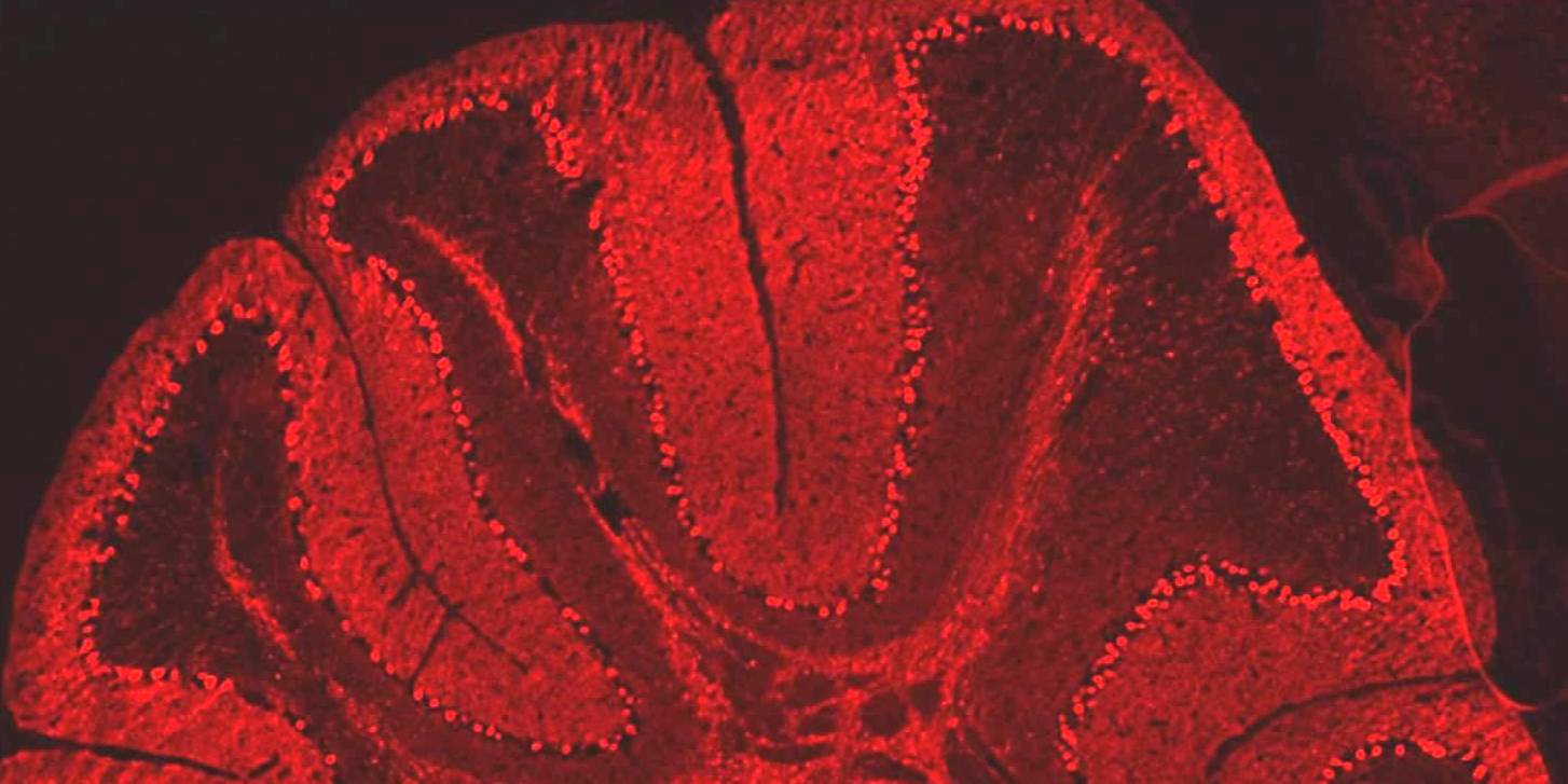 Symposium "Exploring Neurodegenerative Diseases - from macro to micro scale"