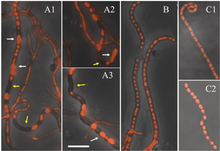 Analiza fluorescencijskim mikroskopom pokazuje defekt u segregaciji kromosoma u bakteriji koja ne sintetizira protein SsbB (A 1-3; žute i bijele strijel...