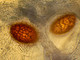 Tuber macrosporum Tuber macrosporum