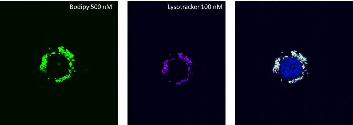 Kolokalizacija s lysotrackerom