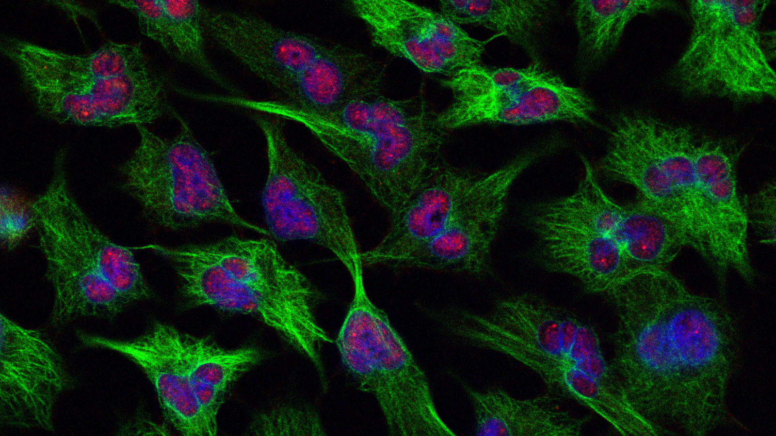 Mikrotubuli kao obrambeno sredstvo stanica raka jajnika protiv lijekova različitih mehanizama djelovanja