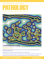 Paper by RBI Scientists Published in the American Journal of Pathology