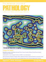 Rad znanstvenika IRB-a objavljen u The American Journal of Pathology