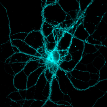 Laboratory for Neurodegenerative Disease Research